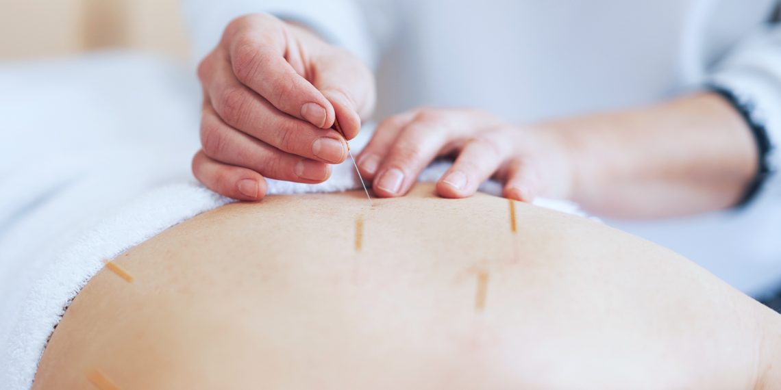 Acupuntura en el embarazo: equilibrio para la mamá y el bebé
