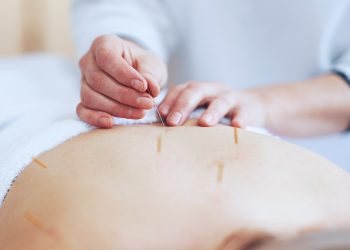 Acupuntura en el embarazo: equilibrio para la mamá y el bebé